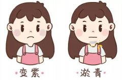 中医体质辨识仪器浅析容易淤青当心是血瘀体质