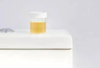 医用尿碘分析仪设备的尿碘检测值受哪些因素影响