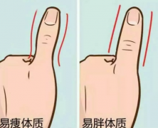 山西吕梁中医体质辨识仪系统瘦身也得看体质?这几种体质了解一下10.15